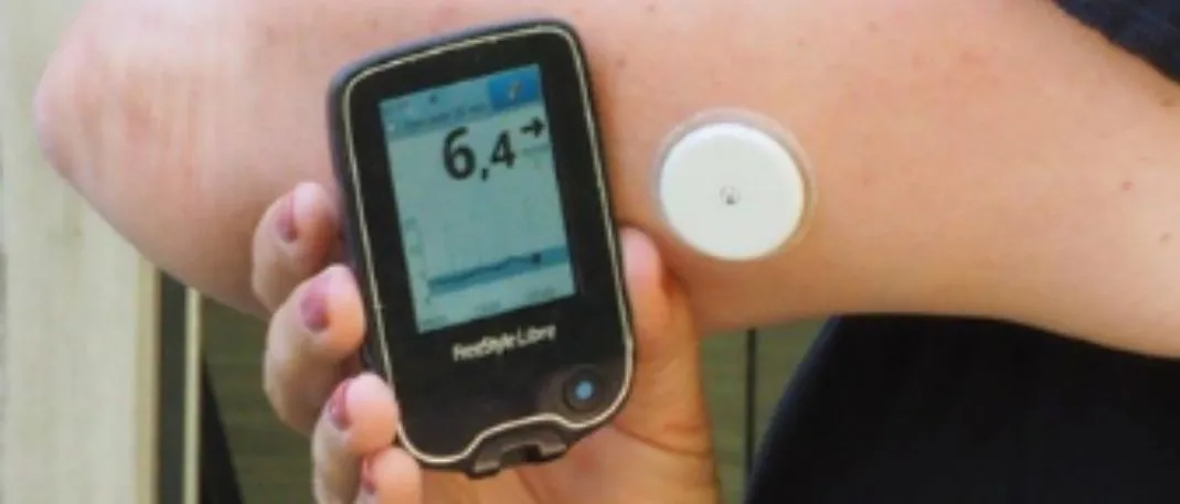 Een sensor bij diabetes type 2 zonder intensief insulinegebruik